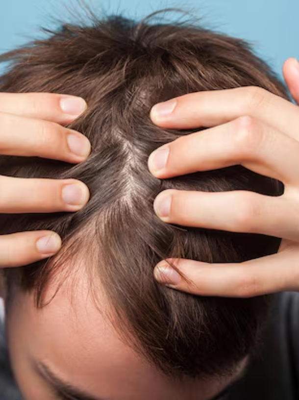 closeup-de-jovem-segurando-o-cabelo-com-as-maos-mostrando-couro-cabeludo-limpo-e-cabelo-castanho-sau